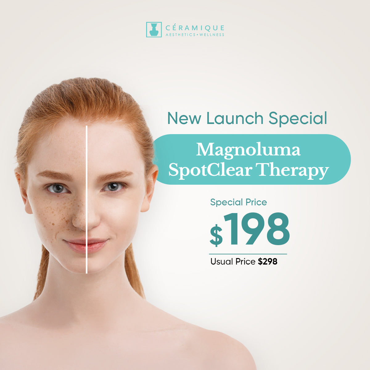 MagnoLuma SpotClear 疗法| 首次试用– Ceramique Aesthetics