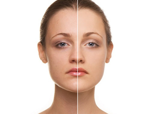 3 Things That You Need To Know About Anti Aging Skincare