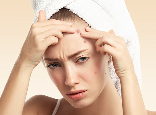 A Simple Guide To Treating Hair Problems & Acne For Young Adults